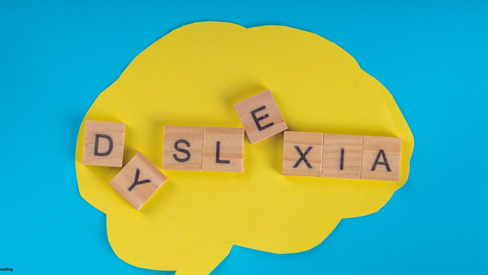 A Comprehensive Guide to Understanding Dyslexia